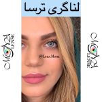 ترسا لاکچری - لنا گری - طوسی سبز دورخط دار - Image 4