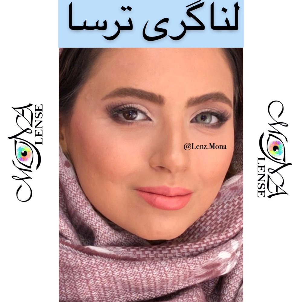 ترسا لاکچری - لنا گری - طوسی سبز دورخط دار - Image 5