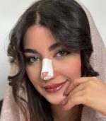 لومنتو - لومو گرین